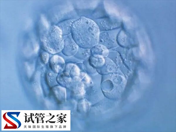 胚胎移植失败后需要注意什么