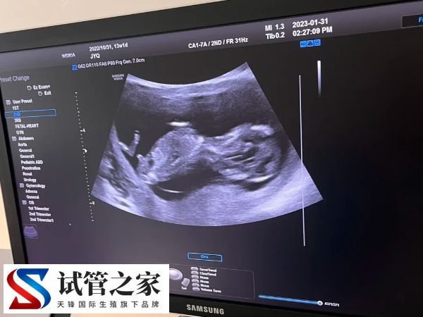 冻囊胚什么时候移植好(图1)