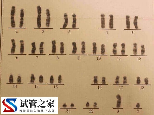 5号染色体三体是什么意思(图1)