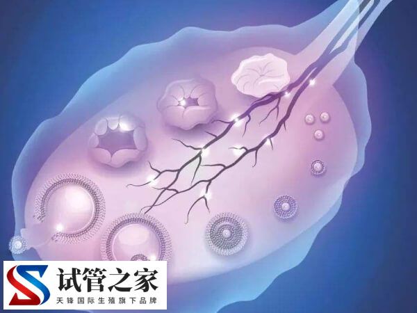 高龄女性去俄罗斯做试管婴儿要怎么做(图1)