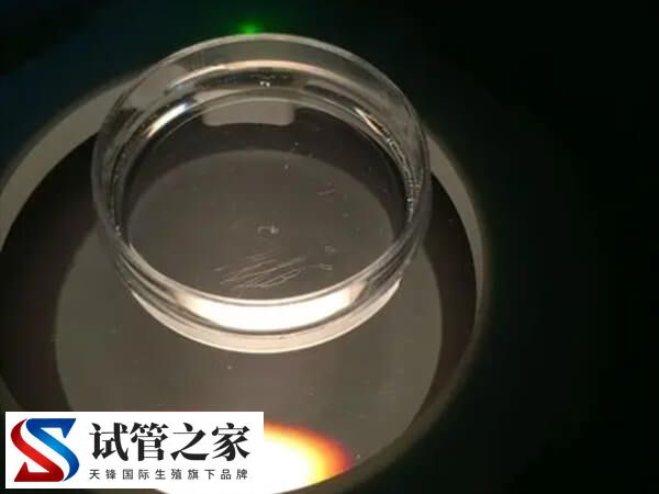 睾丸先天性发育不良镜下取精成功率多大(图2)