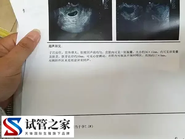 脑供血不足做试管有没有影响(图1)