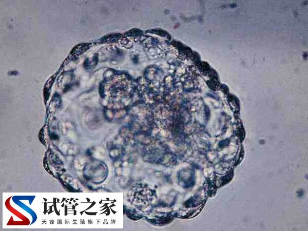 热敷腹部会不会烫死精子和卵子(图2)