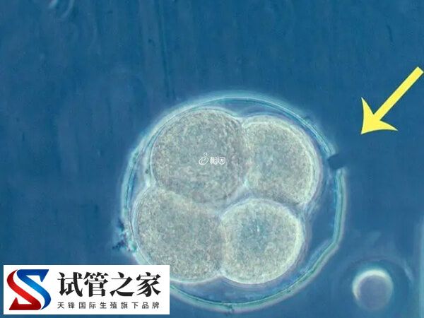 什么叫人体胚胎孵化项目(图1)