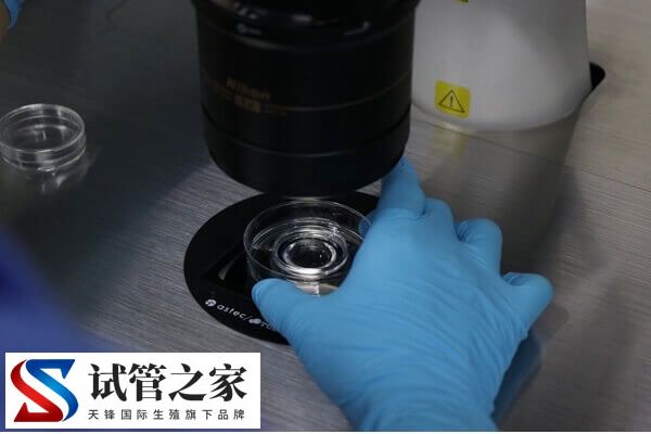试管移植第17天出血的原因有几种(图3)