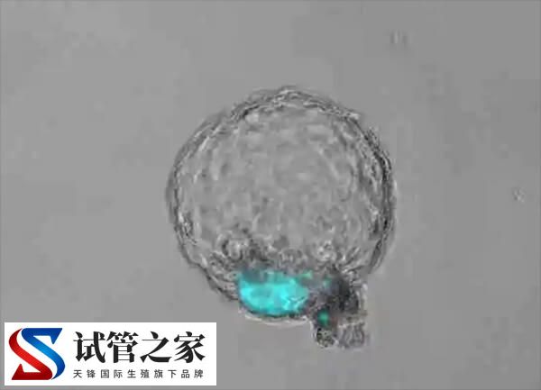 6bb囊胚容不容易生男孩(图3)