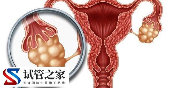 性激素六项检查报告单怎么看(图3)