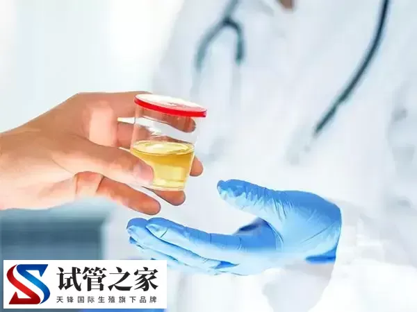 试管婴儿前为什么要检查肾功能(图1)