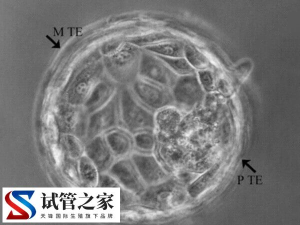 试管婴儿囊胚培养技术是什么(图2) 试管婴儿囊胚培养技术是什么(图2)