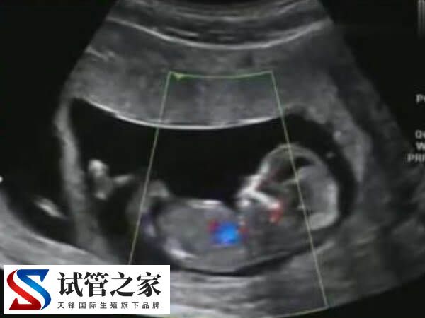 胚胎移植过后需要注意什么(图2)