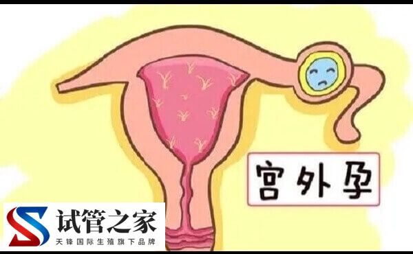 早孕期阴道出血的原因有哪些(图1)