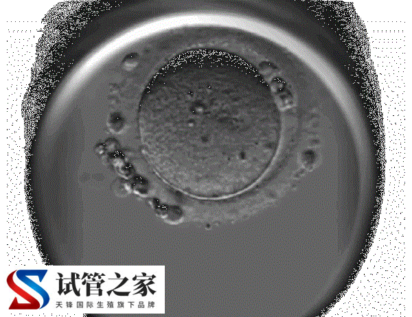 试管婴儿移植三级胚胎的成功率有40%吗？(图1)