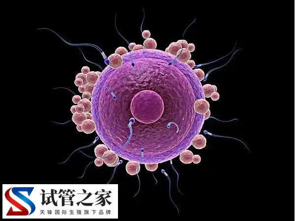 多囊卵巢促排后空卵泡的原因是什么(图1) 多囊卵巢促排后空卵泡的原因是什么(图1)