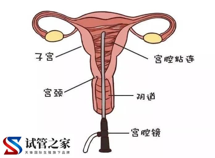 做宫腔镜检查痛不痛(图2)