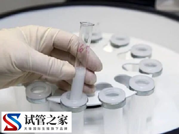 离心后镜检偶见几条活动精子拿去做试管婴儿能成功吗?(图1) 离心后镜检偶见几条活动精子拿去做试管婴儿能成功吗?(图1)