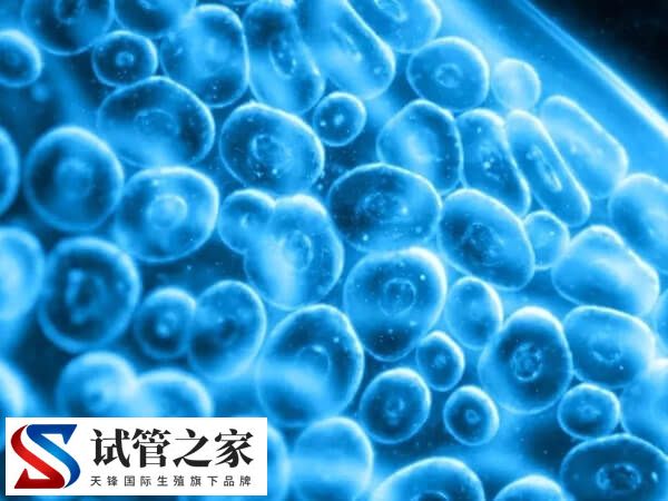 促排后左右卵巢一共有36个卵泡怎么回事?(图1) 促排后左右卵巢一共有36个卵泡怎么回事?(图1)