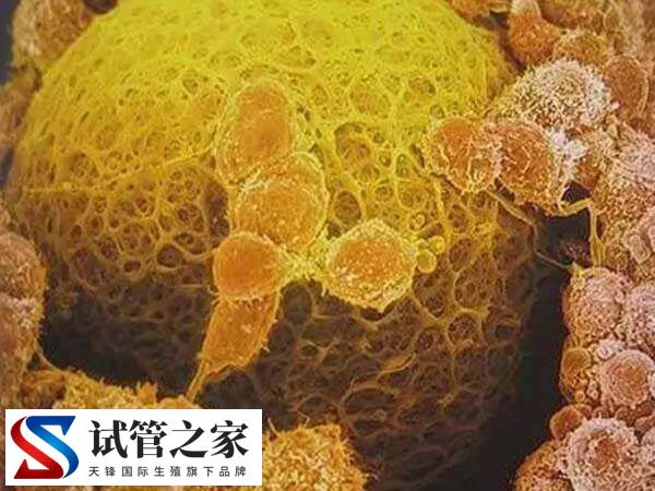 卵泡发育不良能不能做试管婴儿(图3)