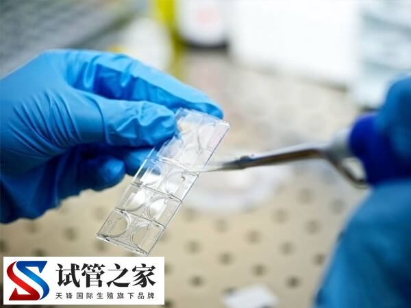 取卵时能不能看出卵子质量(图1)