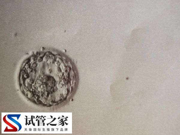 5天的囊胚5bb质量成功率有多高(图1)