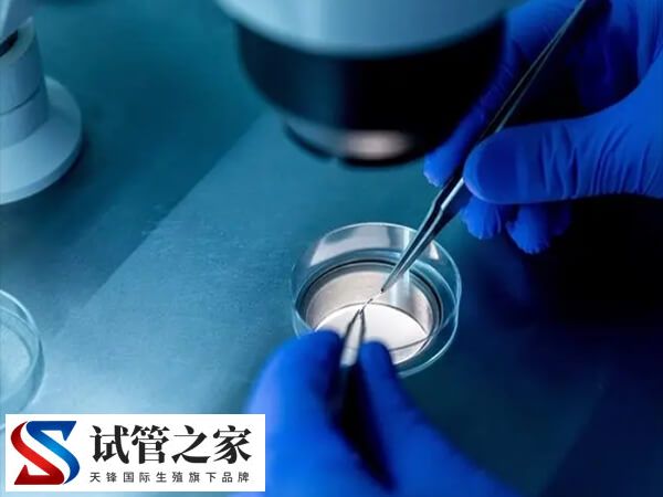 这四类女性做试管婴儿成功率很高,看看你是其中之一吗？(图1)