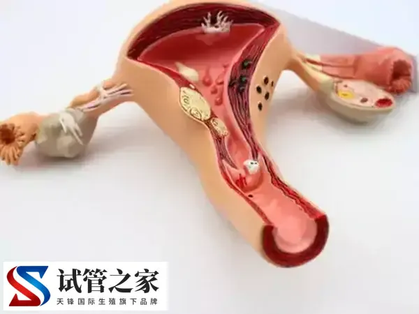始基子宫怎么治疗