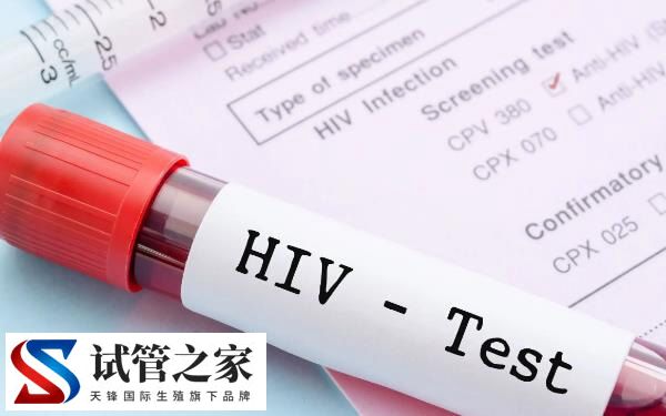 妇幼保健院接不接艾滋病的产妇(图2) 妇幼保健院接不接艾滋病的产妇(图2)