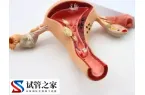始基子宫怎么治疗